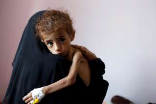 A woman holds a malnourished child Oct. 6 at a hospital in Sanaa, Yemen. Aid agencies and Catholic officials are sounding the alarm on Yemen&#039;s spiraling humanitarian crisis, calling on the combatants to end the war and make badly need assistance available. 