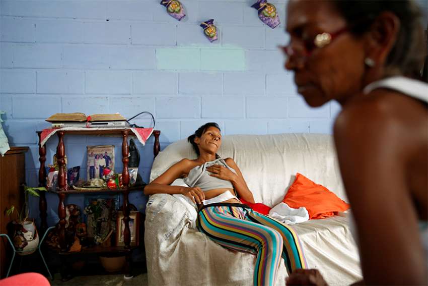 In this 2016 file photo, a woman in San Francisco de Yare, Venezuela, rests on a couch in her home while she recovers from a sterilization surgery. The Catholic Church teaches that sterilization is morally unacceptable, but a hysterectomy could be morally acceptable if the uterus could not sustain a pregnancy, said the Congregation for the Doctrine of the Faith. 