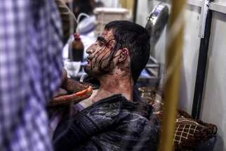 An injured man receives treatment inside a field hospital in Douma, Syria, after April 3 airstrikes. A suspected chemical attack in a town in Syria&#039;s rebel-held Idlib province killed dozens of people April 3.