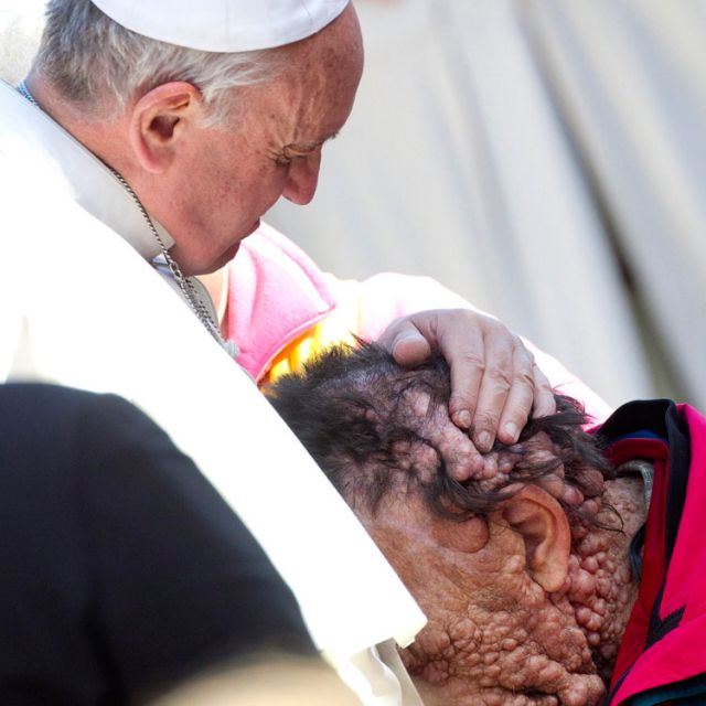 Pope Francis embraces Vinicio Riva, 53, during his general audience in St. Peter&#039;s Square at the Vatican Nov. 6. Riva, who is afflicted with neurofibromatosis, said receiving the pope&#039;s embrace was like being in paradise. Riva is from a small village nea r Vincenza in northern Italy.