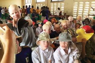 The Carmelite sisters run an orphanage for albino children in Mwanza, Tanzania.